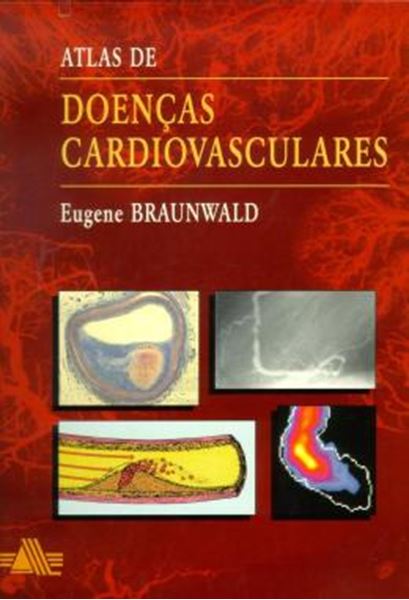 Picture of ATLAS DE DOENCAS CARDIOVASCULARES