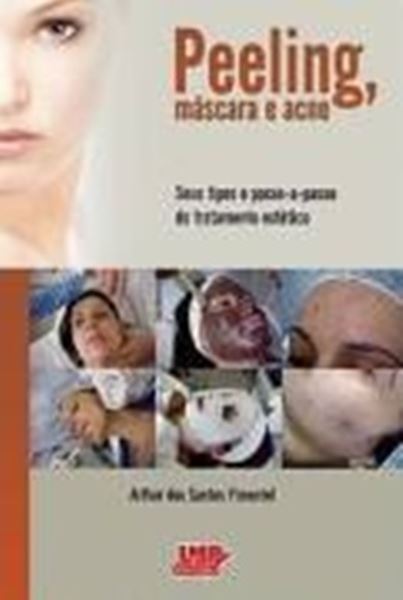Picture of PEELING, MASCARA E ACNE