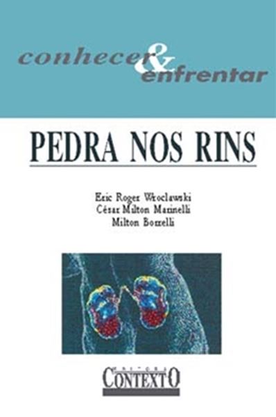 Picture of PEDRA NOS RINS