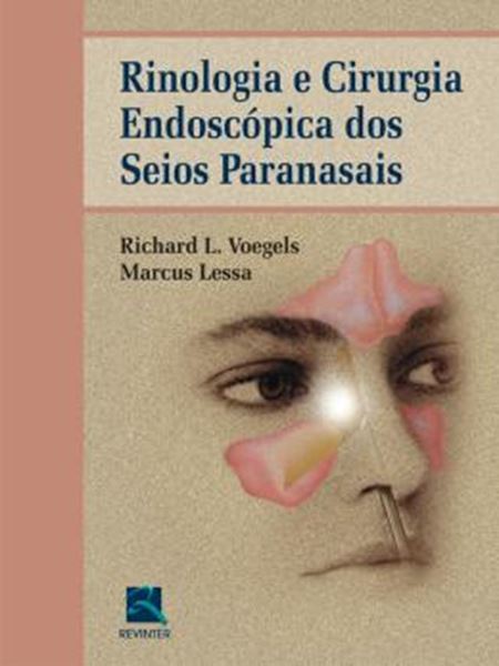 Picture of RINOLOGIA  E CIRURGIA ENDOSCOPICA DOS SEIOS PARANASAIS