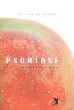 Imagem de PSORIASE - DESCOBERTAS ALEM DA PELE