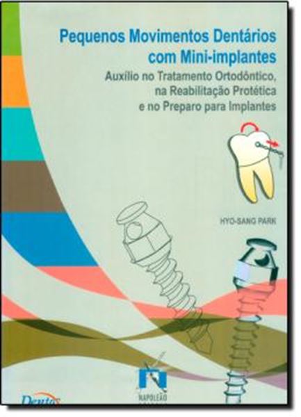 Picture of PEQUENOS MOVIMENTOS DENTARIOS COM MINI-IMPLANTES