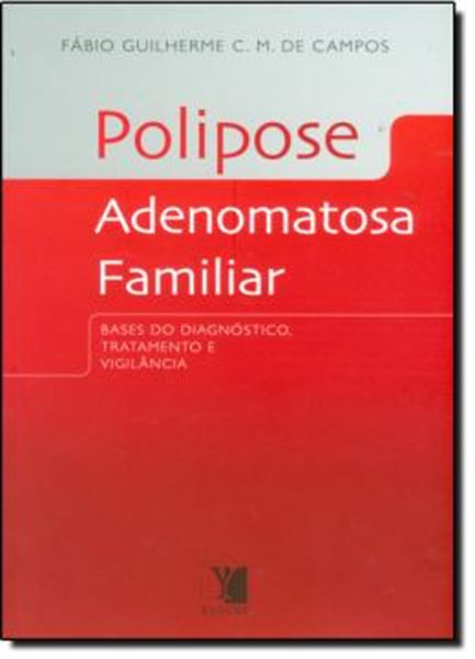 Picture of POLIPOSE ADENOMATOSA FAMILIAR: BASES DO DIAGNOSTICO, TRATAMENTO E VIGILANCIA