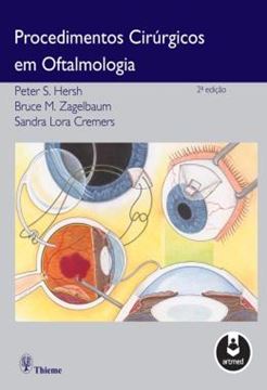 Imagem de PROCEDIMENTOS CIRURGICOS EM OFTALMOLOGIA