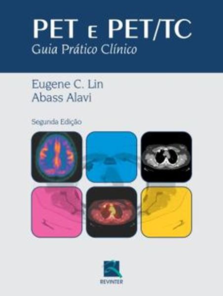 Picture of PET E PET/TC - GUIA PRATICO CLINICO - 2ª ED