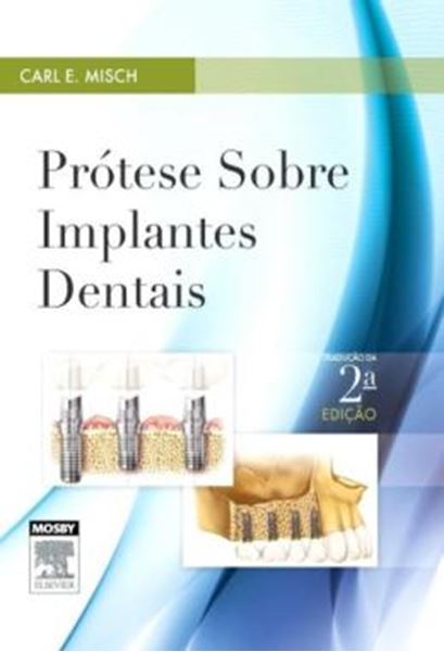 Picture of PROTESE SOBRE IMPLANTES DENTAIS - 2 ED