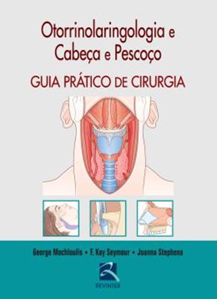 Picture of OTORRINOLARINGOLOGIA E CABECA E PESCOCO - GUIA PRATICO DE CIRURGIA