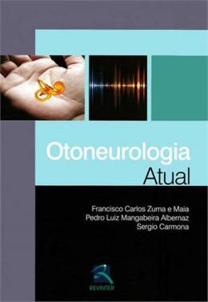 Picture of OTONEUROLOGIA ATUAL