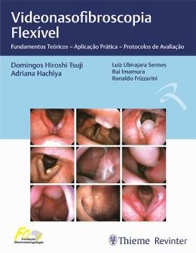 Imagem de VIDEONASOLARINGOSCOPIA