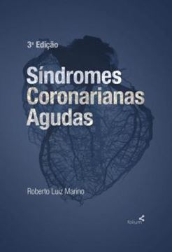 Imagem de SINDROMES CORONARIANAS AGUDAS