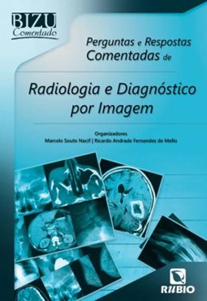 Picture of BIZU COMENTADO – PERGUNTAS E RESPOSTAS COMENTADAS DE RADIOLOGIA E DIAGNOSTICO POR IMAGEM