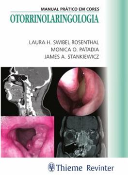 Imagem de OTORRINOLARINGOLOGIA - MANUAL PRATICO EM CORES