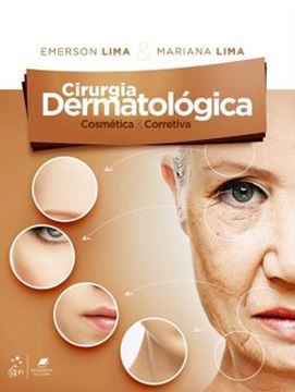 Imagem de CIRURGIA DERMATOLOGICA COSMETICA E CORRETIVA