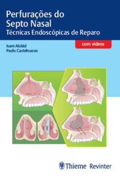 Imagem de PERFURACOES DO SEPTO NASAL - TECNICAS ENDOSCOPICAS DE REPARO