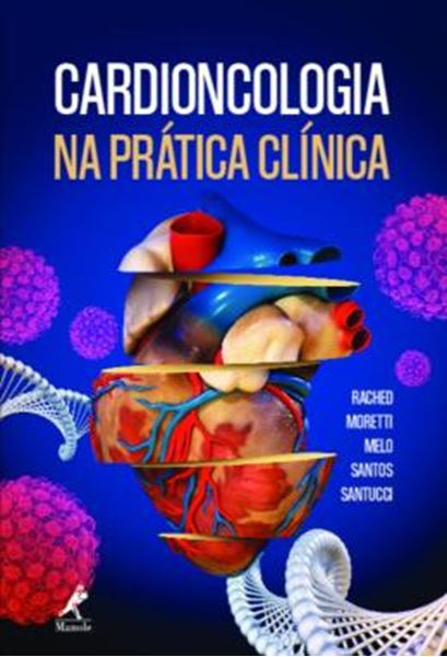 Picture of CARDIONCOLOGIA NA PRATICA CLINICA