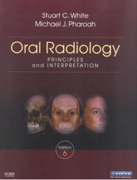 Imagem de ORAL RADIOLOGY - PRINCIPLES AND INTERPRETATION - 6TH ED