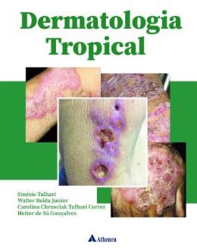Imagem de DERMATOLOGIA TROPICAL