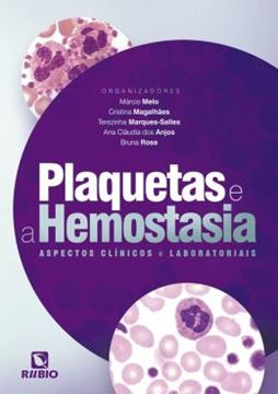 Imagem de PLAQUETAS E A HEMOSTASIA - ASPECTOS CLÍNICOS E LABORATORIAIS