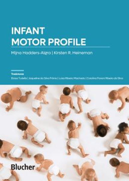 Picture of INFANT MOTOR PROFILE