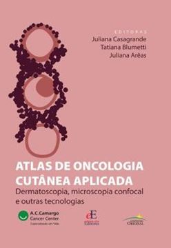 Imagem de ATLAS DE ONCOLOGIA CUTANEA APLICADA