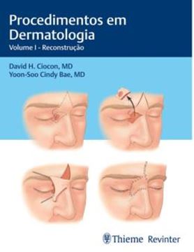Imagem de PROCEDIMENTOS EM DERMATOLOGIA