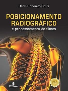 Imagem de POSICIONAMENTO RADIOGRAFICO