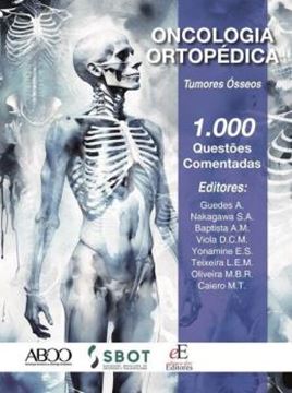 Imagem de ONCOLOGIA ORTOPEDICA - TUMORES OSSEOS