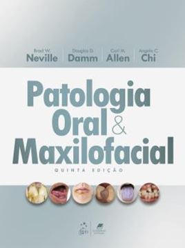 Imagem de PATOLOGIA ORAL E MAXILOFACIAL - 5ª ED