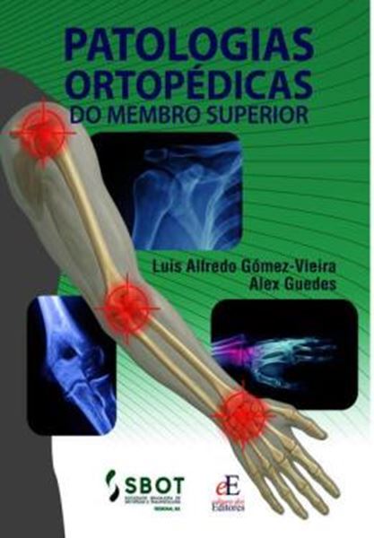 Picture of PATOLOGIAS ORTOPEDICAS DO MEMBRO SUPERIOR