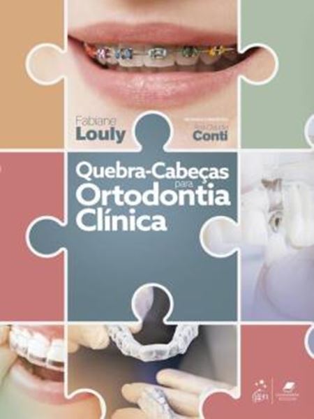 Picture of QUEBRA-CABECAS PARA ORTODONTIA CLINICA