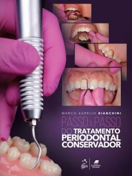 Imagem de PASSO A PASSO DO TRATAMENTO PERIODONTAL CONSERVADOR